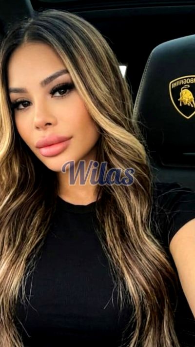 París 72181430, escort en Tamarindo